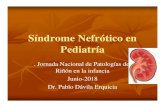 Síndrome Nefrótico en Pediatría - Sociedad Cruceña de Pediatría-Enfermedad de cambios mínimosEnfermedad de cambios mínimos-Glomerulonefritis con proliferación Glomerulonefritis