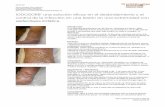 IODOSORB™ una solución eficaz en el desbridamiento y el control …feridas.smith-nephew.pt/casosclinicos/proforeMF08V01.pdf · 2013. 8. 27. · y Elefantiasis linfática. El paciente