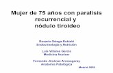Mujer de 76 años con disfonía y nódulo tiroideomail.sendimad.org/sesiones/tiroiditis.pdf · • dolor tiroideo con o sin irradiación • aumento leve del tamaño tiroideo •