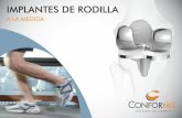 IMPLANTES DE RODILLA...El sistema iTotal CR de reemplazo de rodilla (KRS, por sus siglas en inglés) está destinado a los pacientes con incapacidad o dolor articular agudo en las