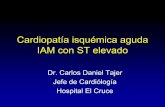 Cardiopatía isquémica aguda IAM con ST elevado5 Sindrome coronario agudo Infarto de miocardio Angina inestable Muerte súbita isquémica V Fuster et al., NEJM 1992; 326:242(modificado)