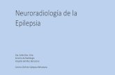 Neuroradiología de la Epilepsia · Colocación correcta del paciente (obtención imágenes simétricas) - Evitar el movimiento (dispositivos de inmovilización)-Imprescindible saber