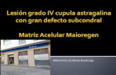 Roberto De Los Mozos Bozalongo · - Localización lesion condral cúpula astragalina - Curetaje en profundidad de lesión . Tercer tiempo quirúrgico Comparativa respecto a punta