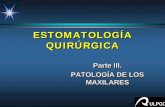 aftosis oral recidivante - University of Las Palmas de Gran ... 11...Capítulo 8Capítulo 8 ALTERACIONES INFLAMATORIAS DEL PERIODONTO. COMPLICACIONES SÉPTICAS DE ORÍGEN DENTARIO