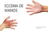 ECCEMA DE MANOS - Sardomitas · 2018. 7. 23. · 6. Marsland AM, Charlmers RJ, Hollis S, et al. Interventions for chronic palmoplantar pustulosis. Cochrane Database Syst Rev 2006;