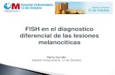 FISH en el diagnostico diferencial de las lesiones ...diferencial de las lesiones melanociticas 1 Maria Garrido Hopital Universitario 12 de Octubre - La mayoría de los melanomas se