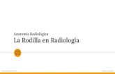Anatomía Radiológica La Rodilla en Radiología · 2021. 2. 13. · Aumento de la densidad, por ej. la enfermedad de Paget. ... tejidos blandos normales en la Rx de rodilla AP y