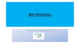 Arritmias · 2018. 1. 10. · Etiopatogenia de las Arritmias → Trastorno del Automatismo → Se altera la producción del estímulo despolarizante: → Nódulo Sinusal descarga