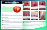 Úlcera venosa en paciente autónomo - Misión Compresión · 2019. 3. 28. · Úlcera venosa en paciente autónomo CONCLUSIONES INTRODUCCIÓN Úlcera de 2x2 cm con lecho exudativo
