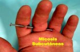 Micosis Subcutáneascolbiosa.com.ar/.../2018/08/2018-6-Micosis-subcutaneas-1.pdf · 2018. 8. 17. · Micosis Subcutáneas •Se subdividen en 1. Cromomicosis 2. Micetomas 3. Esporotricosis