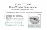 TORACOSTOMIA Open Window Toracostomy