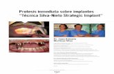 Protesis inmediata sobre implantes “Técnica Silva-Nieto ...