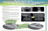 Osteopetrosis: diversos métodos de imágenes en el ...