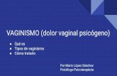 VAGINISMO (dolor vaginal psicógeno)