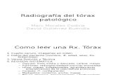 2. Radiograf­a del T³rax Patol³gico