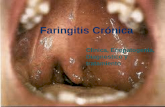 Faringitis Cr³nica