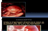 Aborto.presentacion.yennY PAOLA