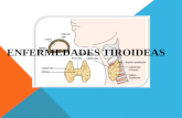Enfermedades Tiroideas Power