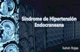 S­ndrome de Hipertensi³n Endocraneana y Tono Muscular