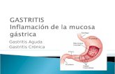 Gastritis prueba