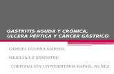 Gastritis aguda y cr³nica, ulcera p©ptica y cancer gstrico