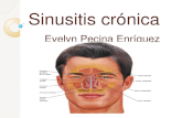 Sinusitis cr³nica
