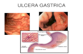 Ulcera gastrica