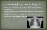 Anatom­a del t³rax en radiograf­a