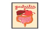 Como Curar La Gastritis Cr³nica