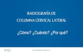 Radiograf­a de Columna Cervical Lateral