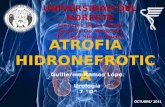 Atrofia hidronefrotica