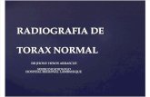Diagn³stico Por Imagen - Radiograf­a de T³rax Normal