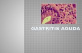 Gastritis aguda terapeutica